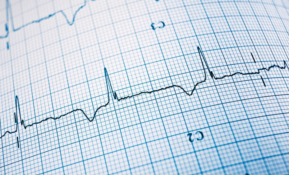 Электрокардиография, Эхокардиография